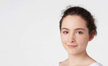 Karma Yagli Ve Akne Egilimli Ciltler Bioderma