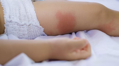 bebek ve cocuklar icin neden ozel bakim urunleri kullanilmali bioderma