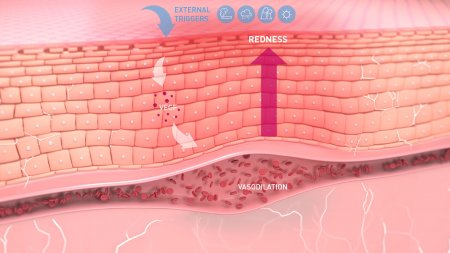 bioderma-sensibio-cilt görüntüsü